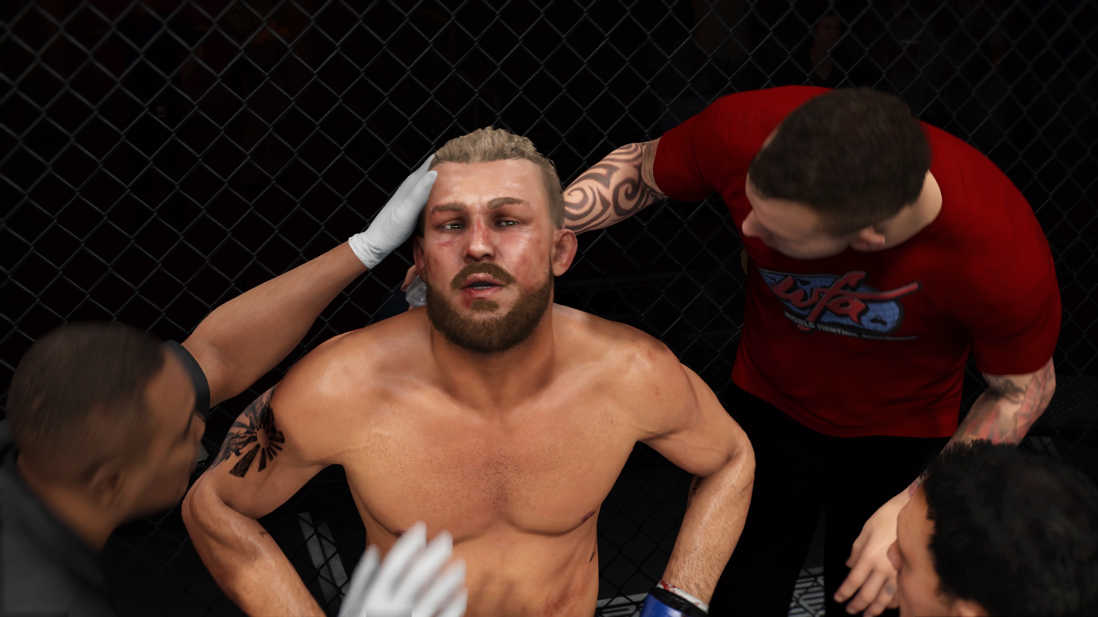 UFC 3 - Bruises